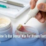 How To Use Dental Wax For Broken Tooth