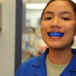 How Do Dental Labs Create Mouthguards?